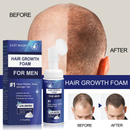 Extra Strength Hair Growth Scalp Foam for Men