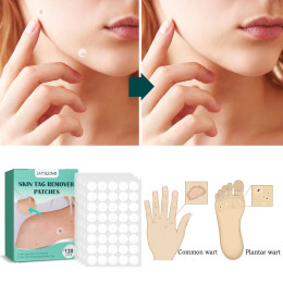 Skin Cleansing Care Wart Removal Patch