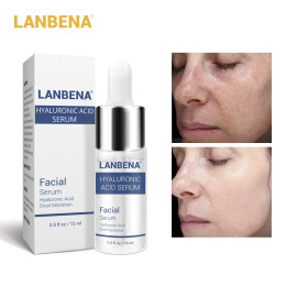 LANBENA hyaluronic acid serum Blackhead Removal Moisturizing Acne Treatment Skin Care Repair Whitening Anti-Aging Wrinkle 15ml